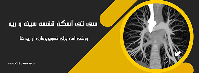 سی تی اسکن قفسه سینه و ریه | روشی امن برای تصویربرداری از ریه ها